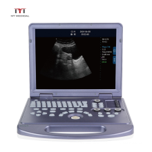 Ultrasound Equipment Clear Imaging Cheapest Portable Ultrasound Machine Price